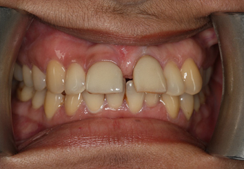 Before - London Bridge Dental Practic