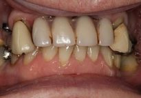 Before - London Bridge Dental Practice