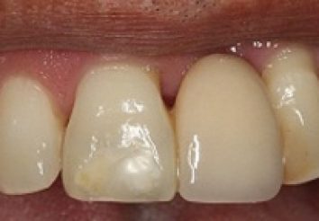 Before - London Bridge Dental Practic
