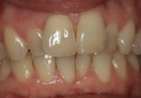 Before - London Bridge Dental Practice