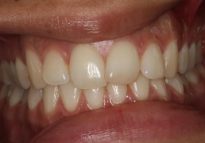 Before - London Bridge Dental Practice