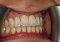 Before - London Bridge Dental Practice