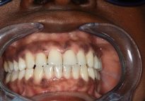 After - London Bridge Dental Practice