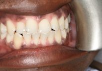 Before - London Bridge Dental Practice