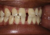 Before - London Bridge Dental Practice