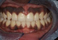 After - London Bridge Dental Practice