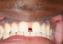 Before - London Bridge Dental Practice