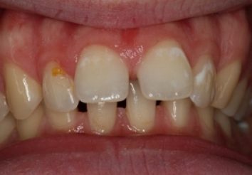 Before - London Bridge Dental Practic
